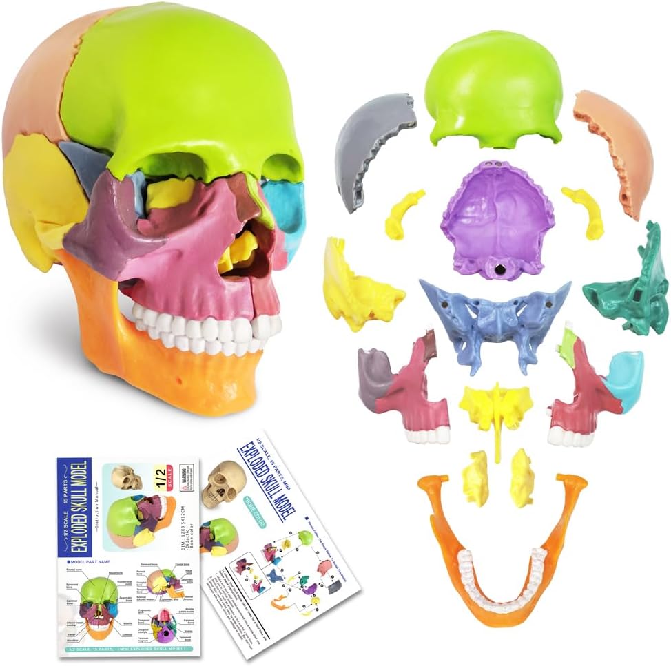 Exploded skull anatomy view, color-coded cranial bone identification